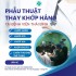 PHẪU THUẬT THAY KHỚP TẠI BỆNH VIỆN THÁI BÌNH