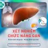 XÉT NGHIỆM CHỨC NĂNG GAN - KHI NÀO CẦN KIỂM TRA?