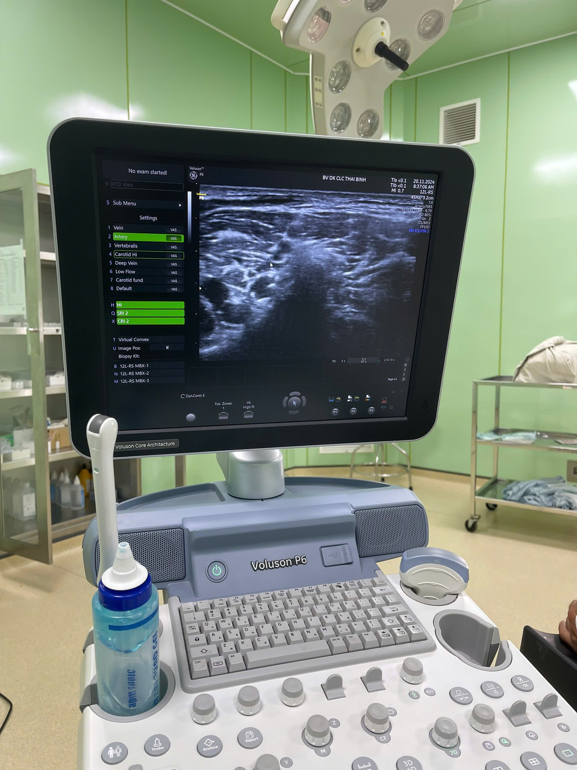 Gây tê đám rối thần kinh cánh tay dưới hướng dẫn của siêu âm